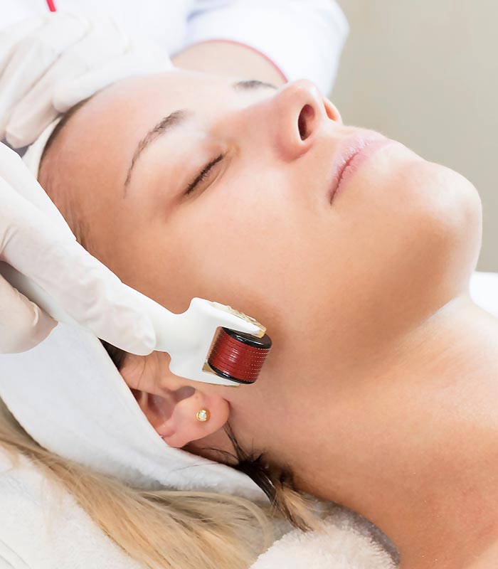 Micro-needling